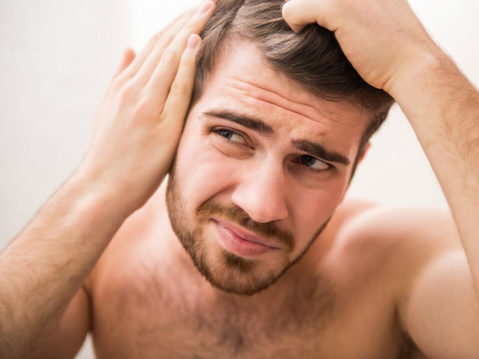 Problemas de cabello