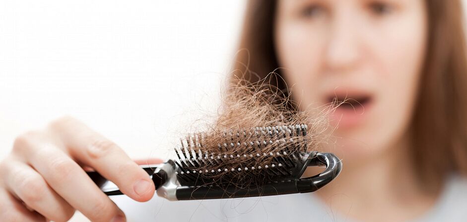Caída del cabello en las mujeres.