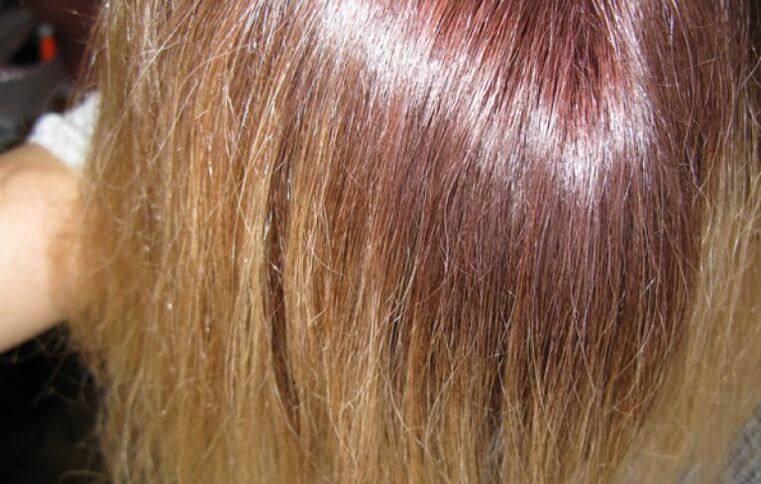 Coloración del cabello fallida